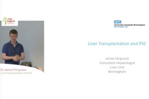 Liver Transplantation for PSC Video Dr James Ferguson