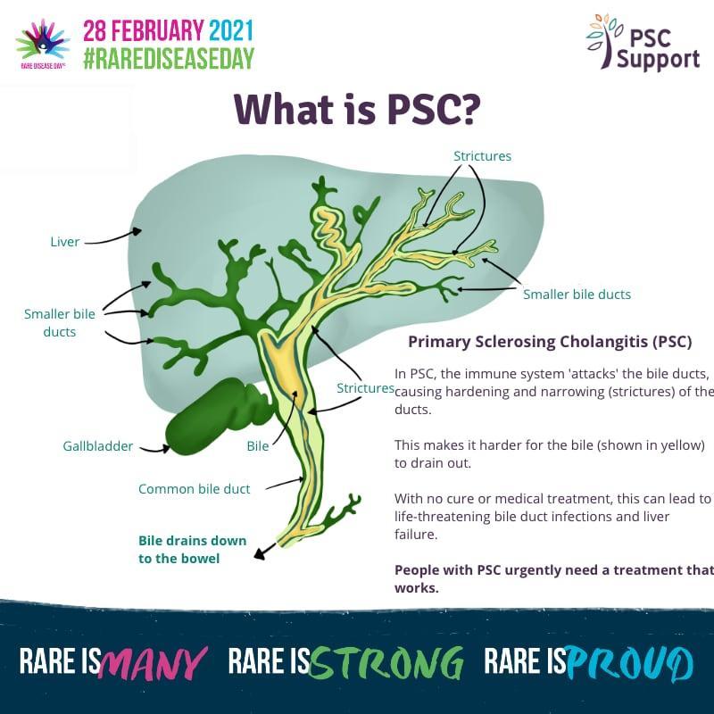 Rare Disease Day 2021 What is PSC